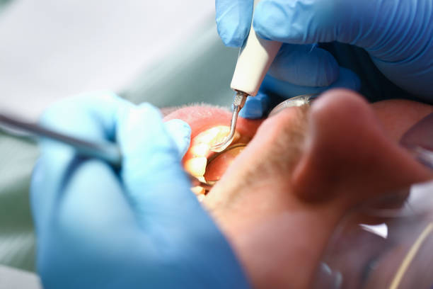 Best Emergency Treatment for Toothache in Monticello, GA
