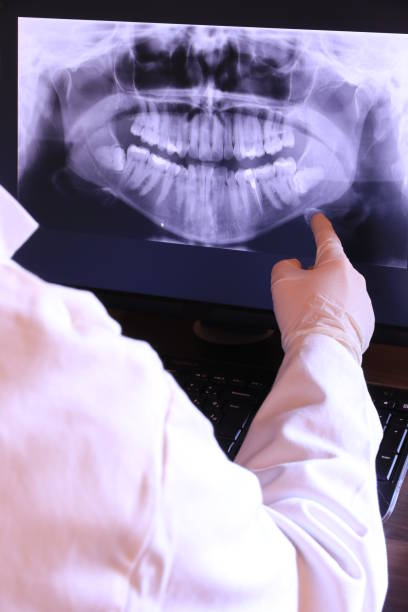 Best Emergency Dental Surgery in Monticello, GA