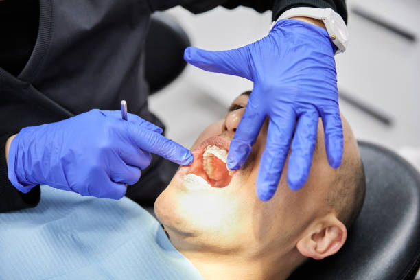 Best Emergency Wisdom Teeth Removal in Monticello, GA