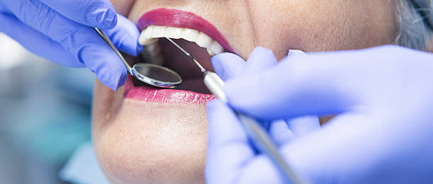 Best Emergency Tooth Extraction in Monticello, GA
